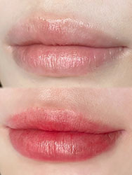 唇 (lip)